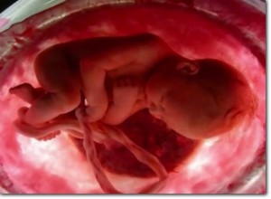 abortion_fetus
